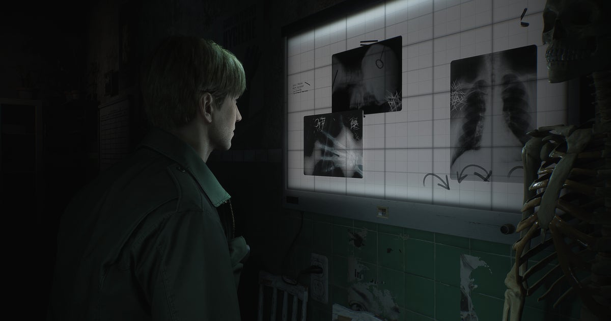 Bloober Team asks fans for patience on Silent Hill 2 Remake, says things are "progressing smoothly"