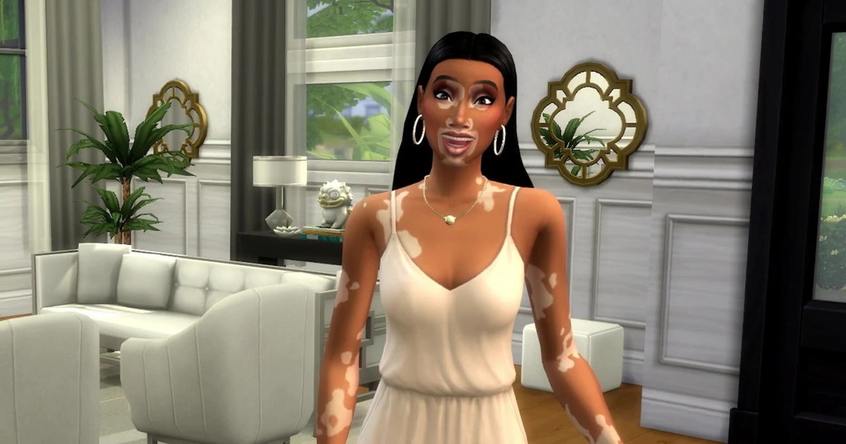 Free Sims 4 update adds Vitiligo skin details with Winnie Harlow collaboration