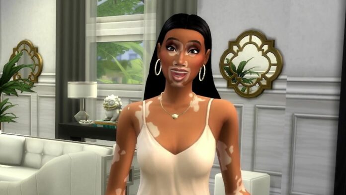 The Sims 4 - A Sim with vitiligo inspired by Winnie Harlow wears a romper and smiles inside a modern, white decor room